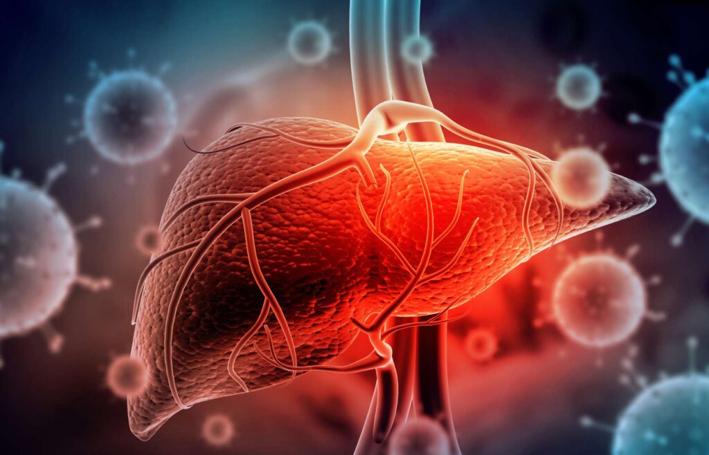 hepatitis