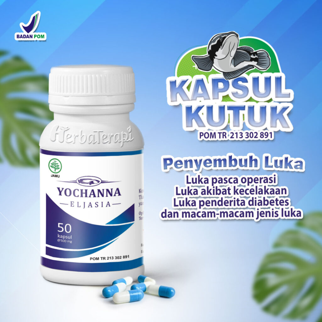 Yochanna pil kutuk terbaik