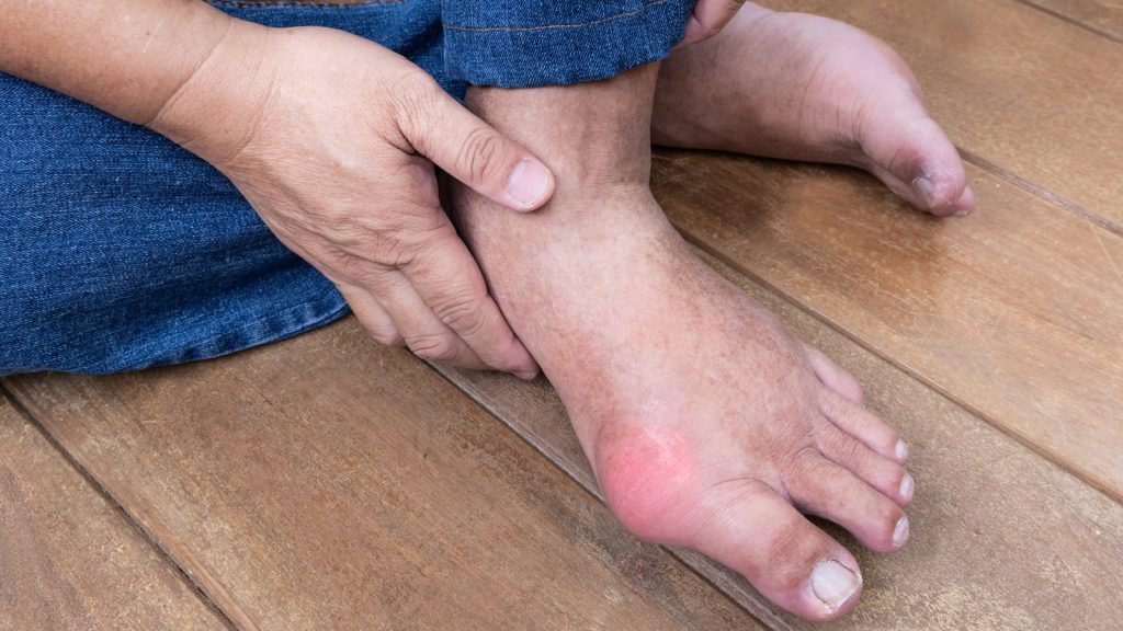 asam urat terkontrol afiapro