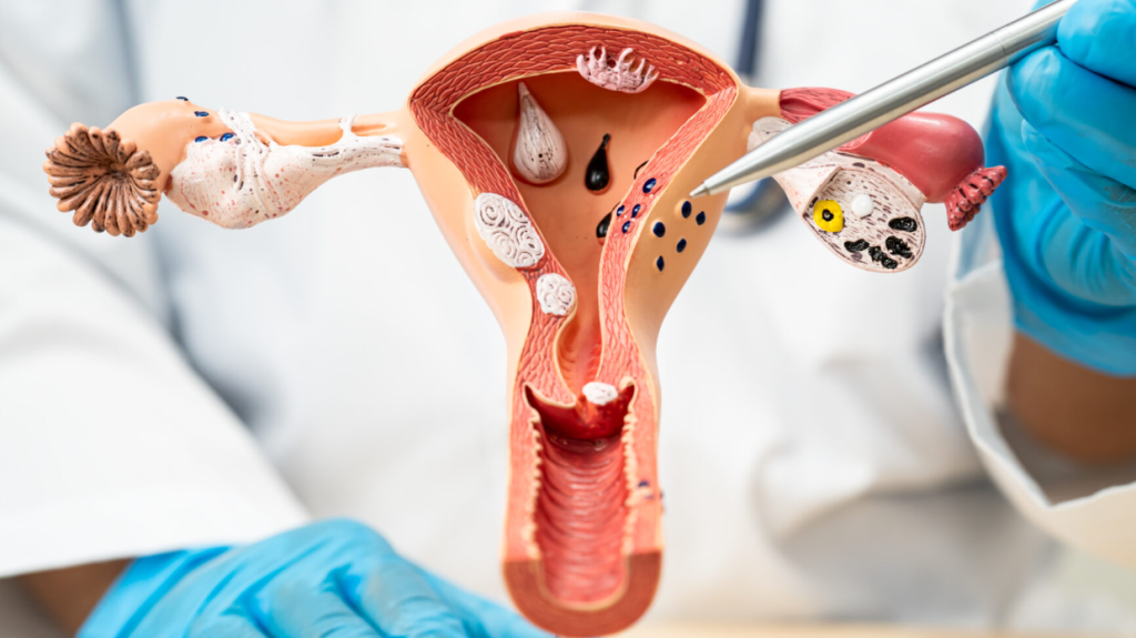 Cara Kerja Paket Promil Vertomen dan Vertina