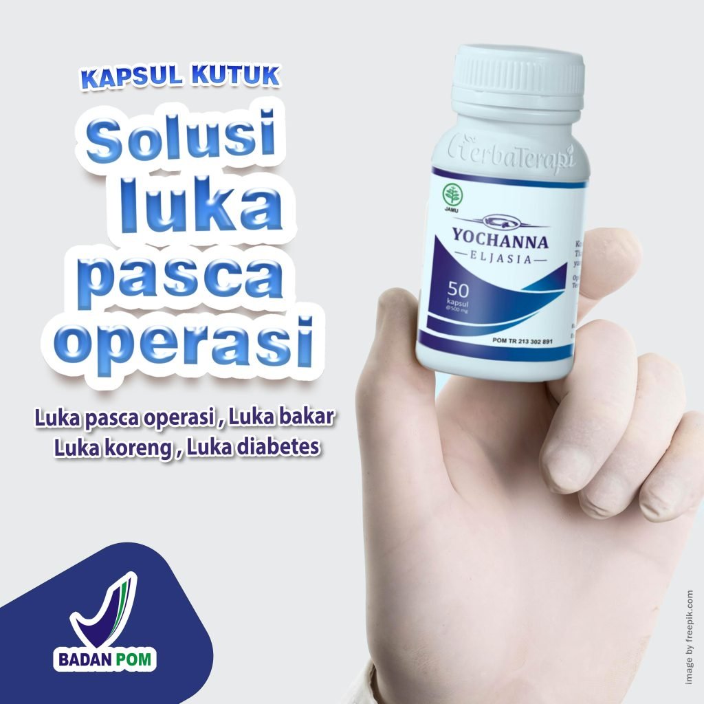 Herbal Luka Caesar yochanna