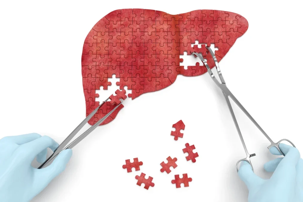 mengenal hepatitis dan cara penangannya - herbatitis