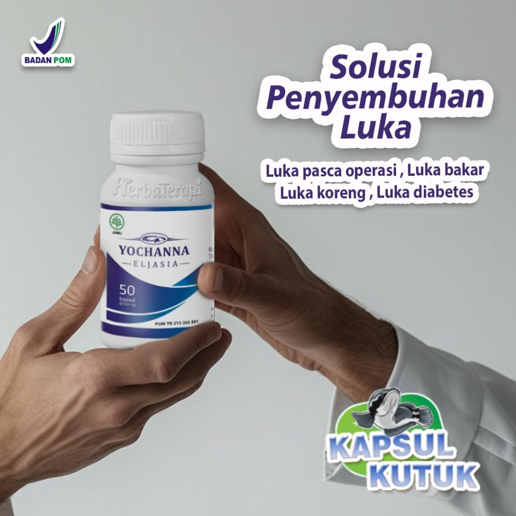 Rekomendasi Kapsul Kutuk Terbaik yochanna