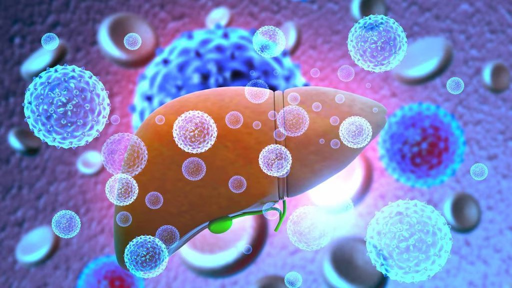 Perbedaan Hepatitis A, B, dan C herbatitis