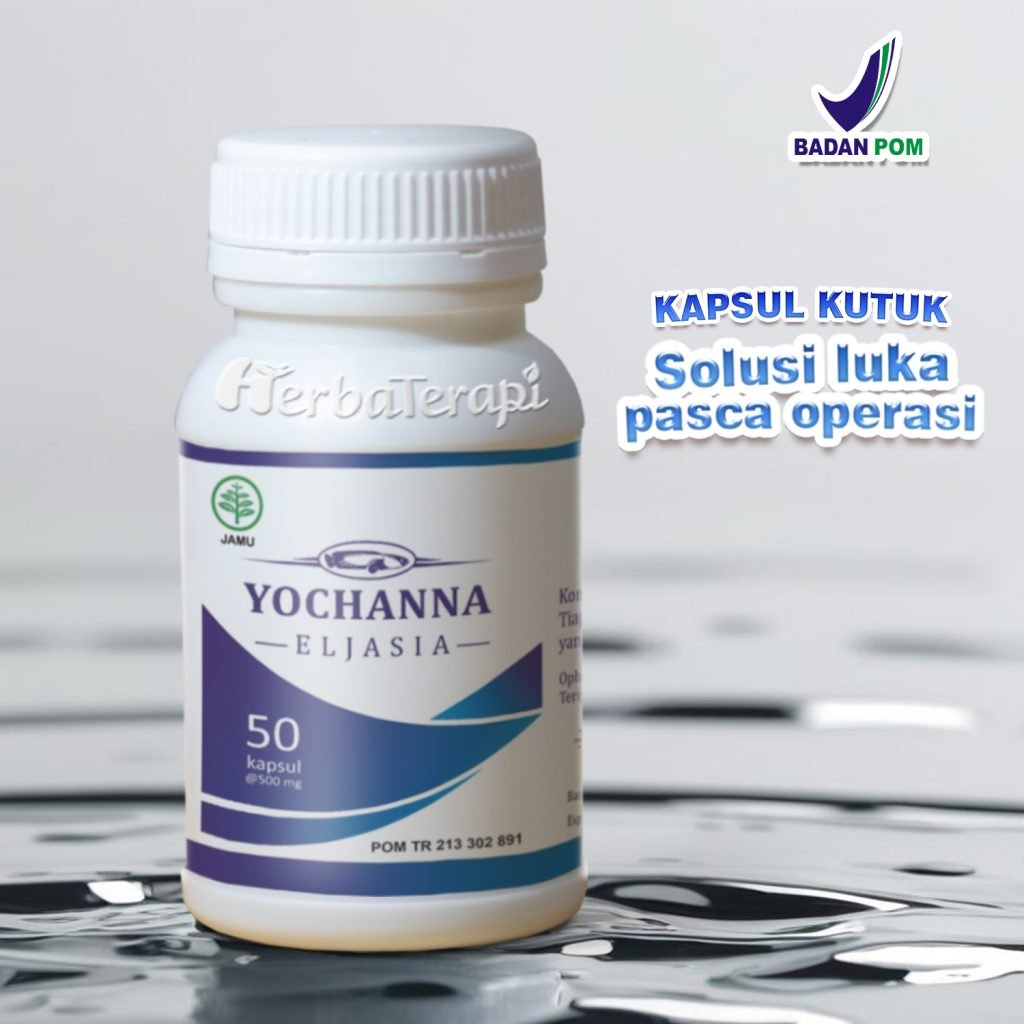 Yochanna Obat Luka Luar