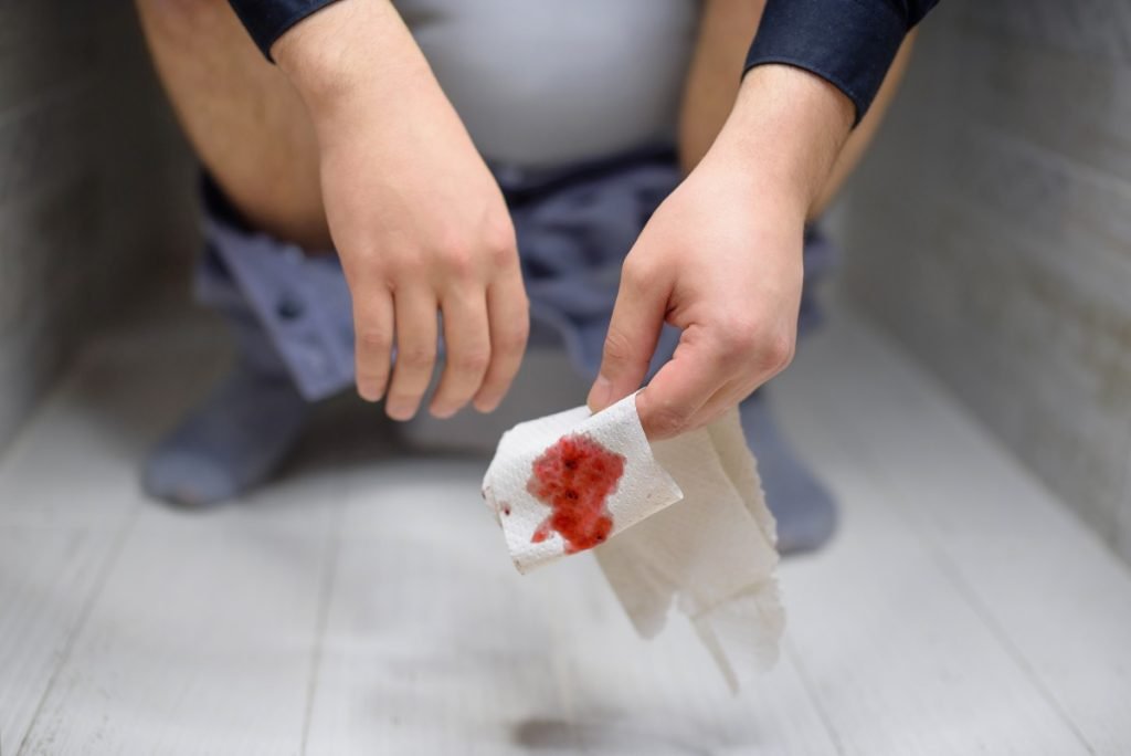 wasir berdarah hemotera