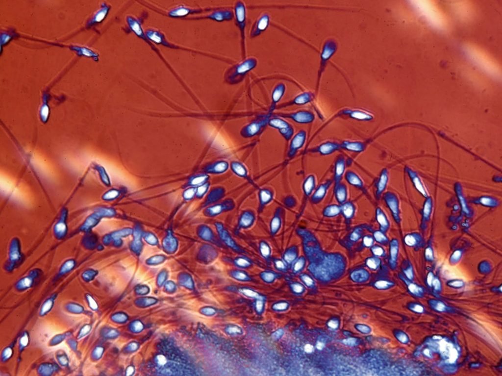 Ciri-Ciri Sperma Encer