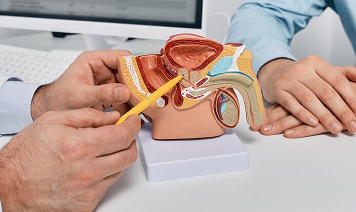kencing lemah - prostat prosterafit