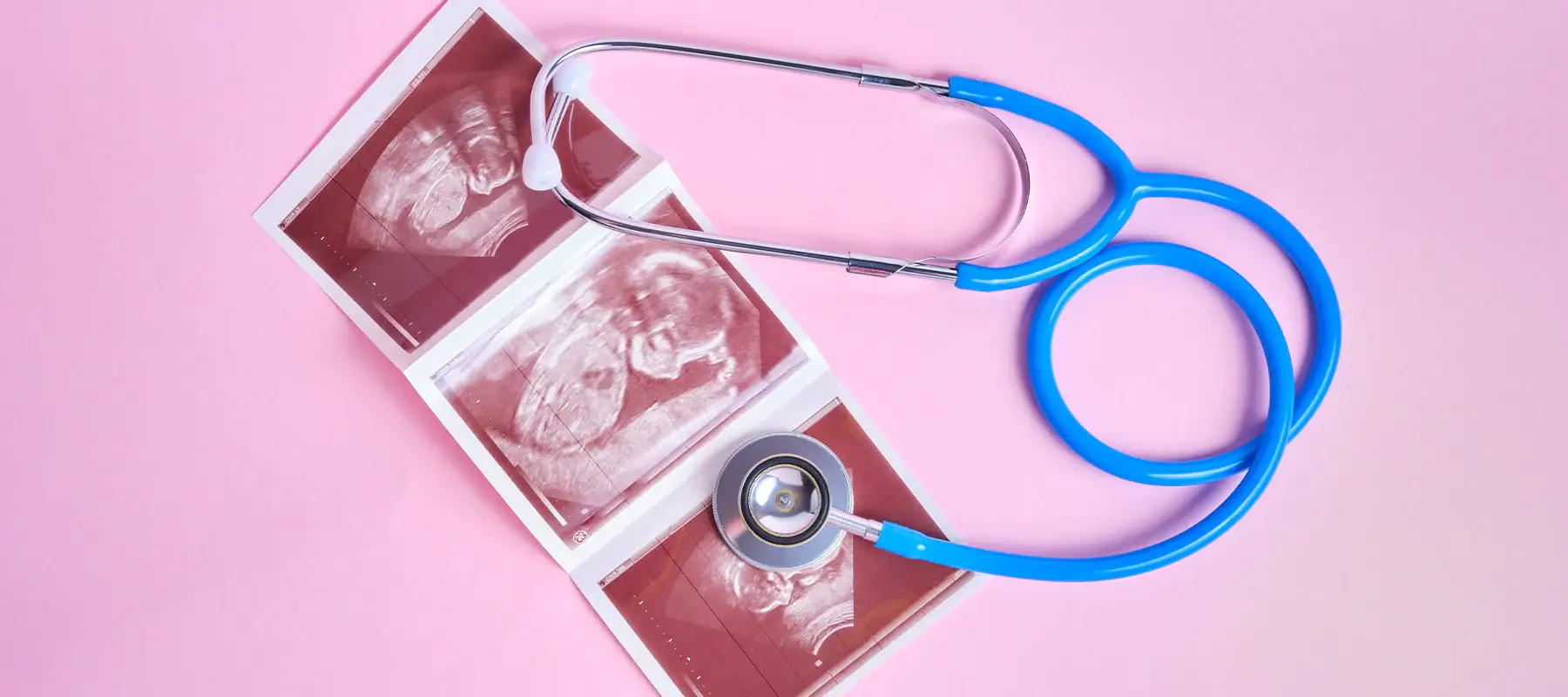 Cepat hamil menurut dokter