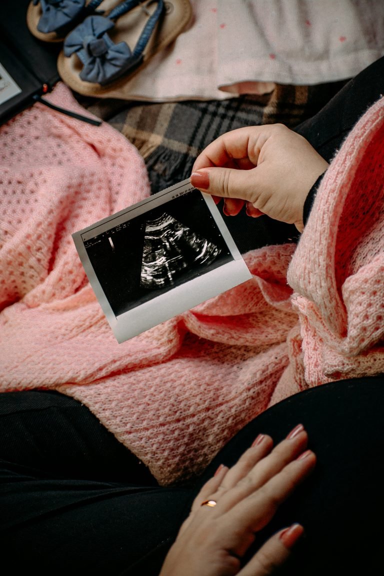 Cepat hamil untuk PCOS