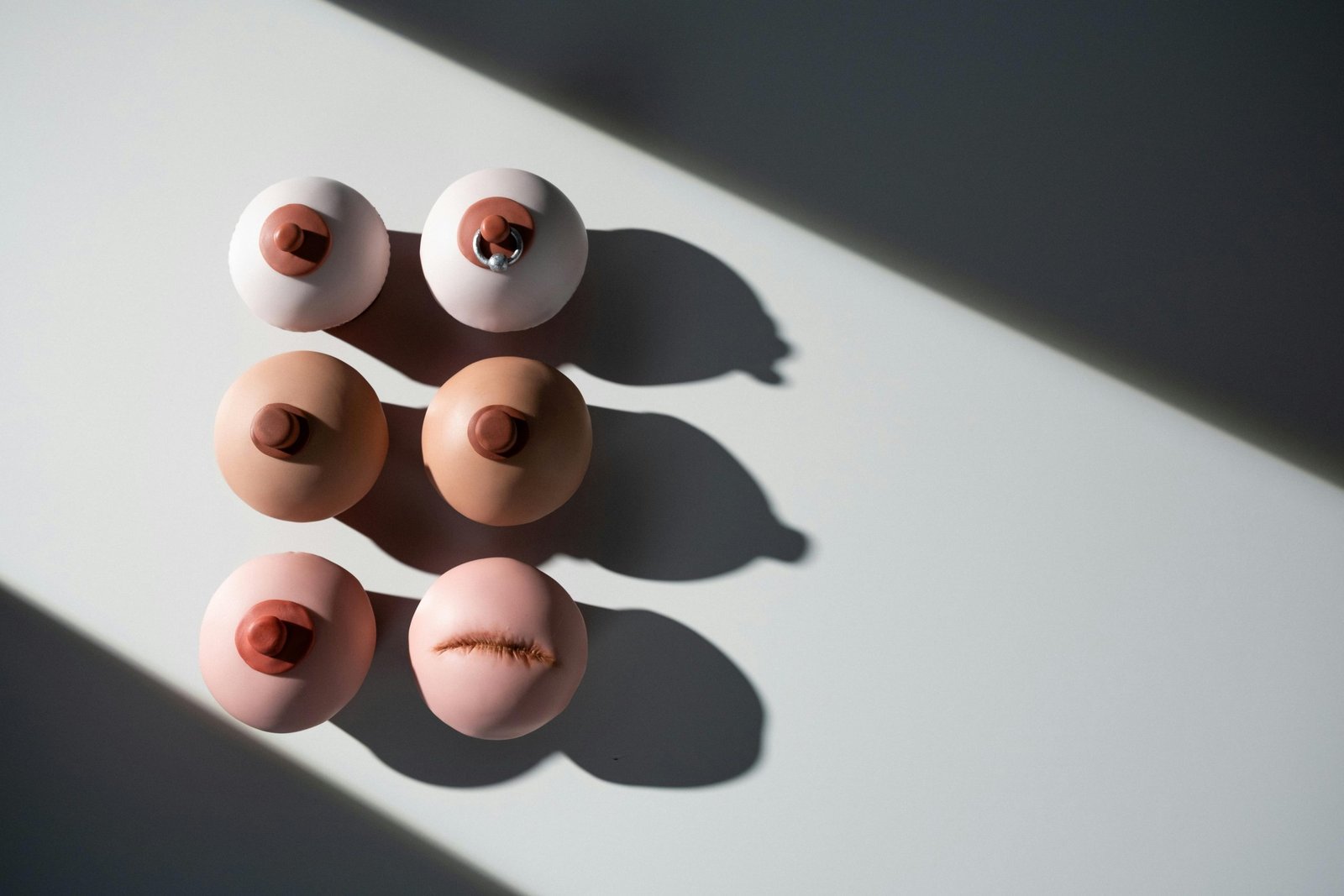 Bentuk Puting Normal