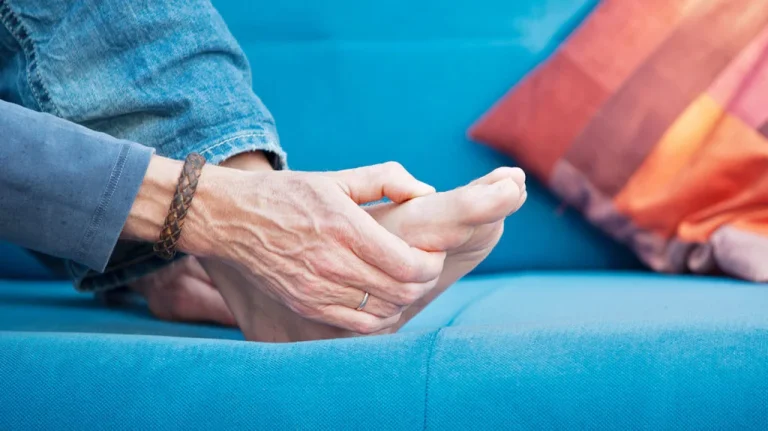 Tanda Asam Urat Tinggi