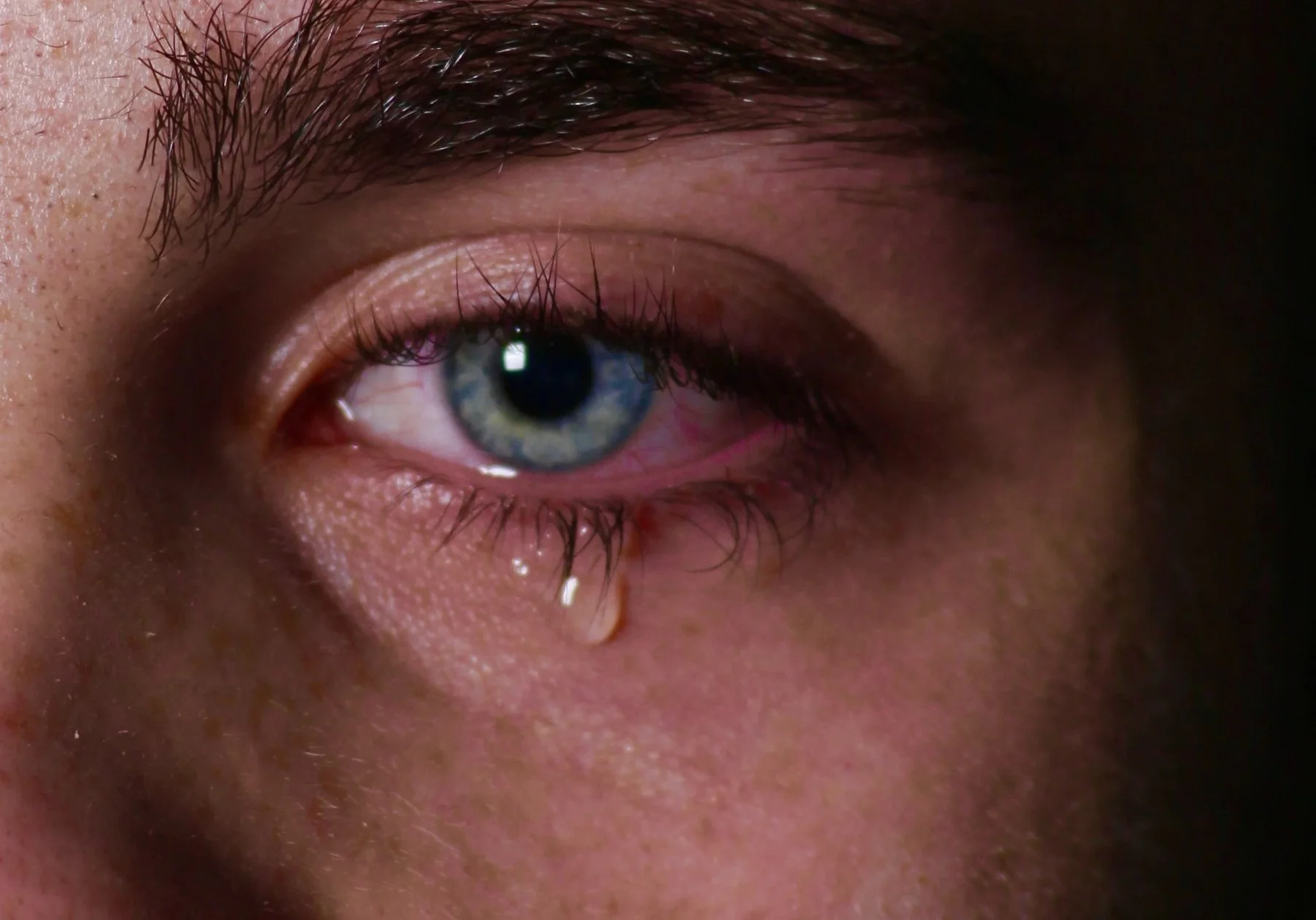 Mata berair tanda penyakit apa