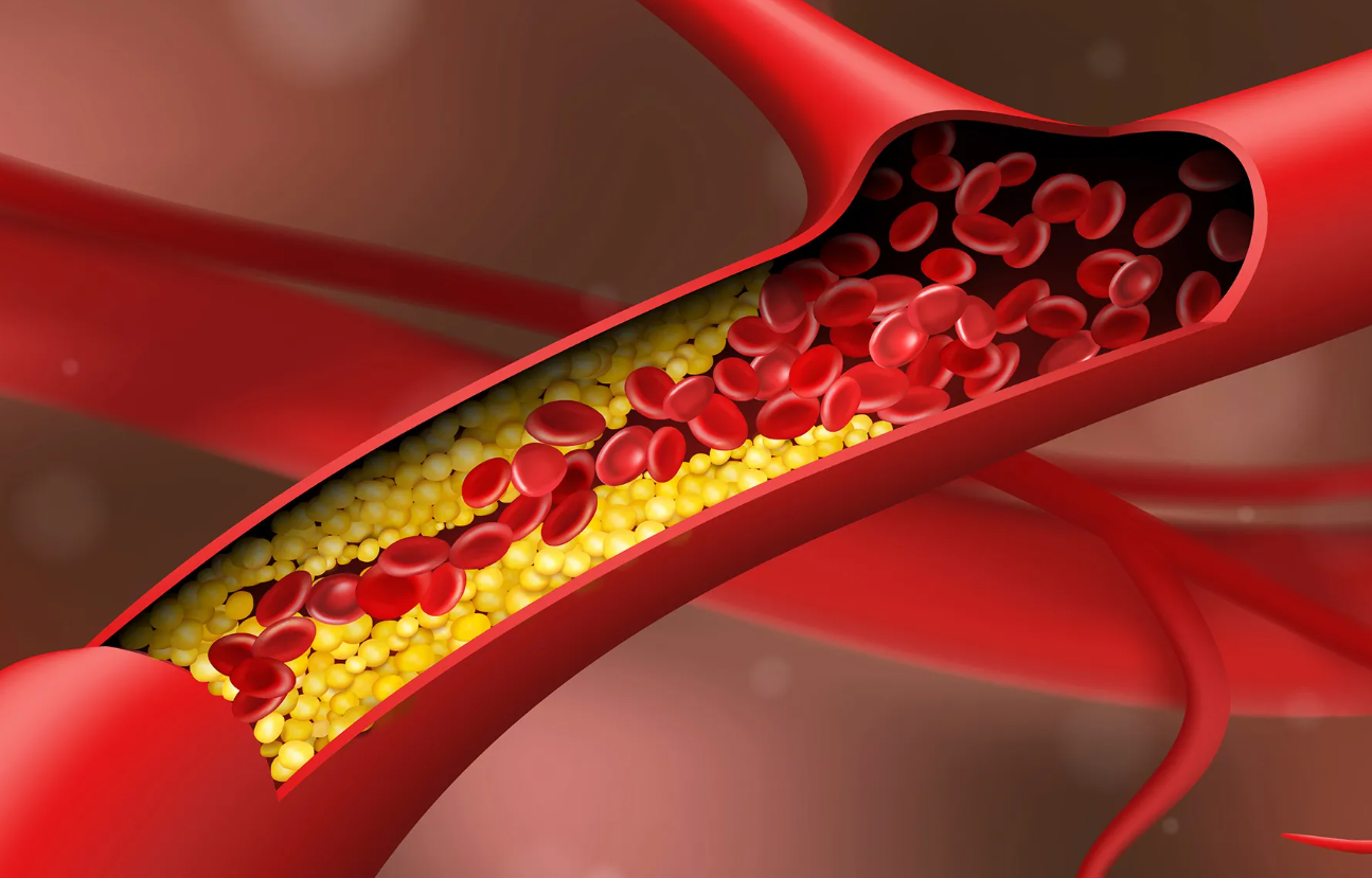 afiapro apa itu purin