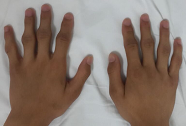 afiapro sendi bengkak