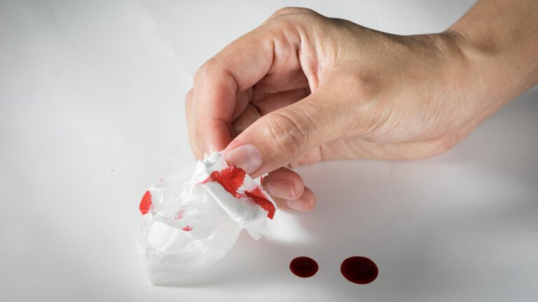 hemotera bab berdarah