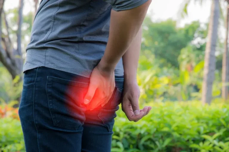 hemotera wasir kronis