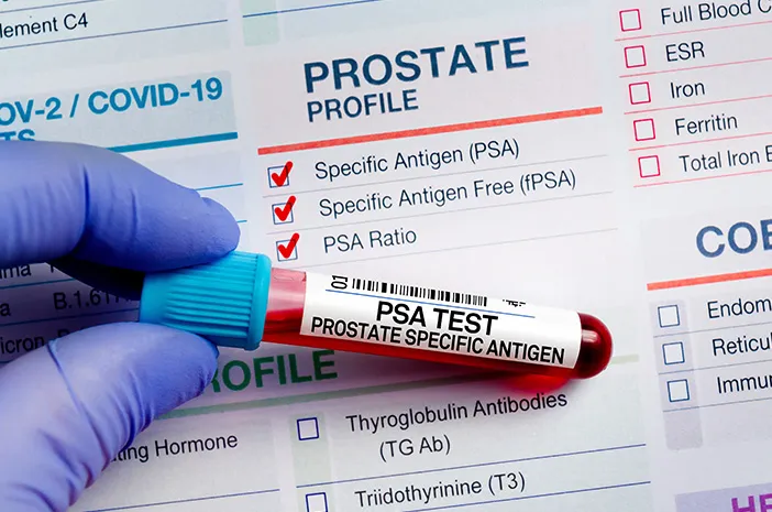 pemeriksaan prostat prosterafit