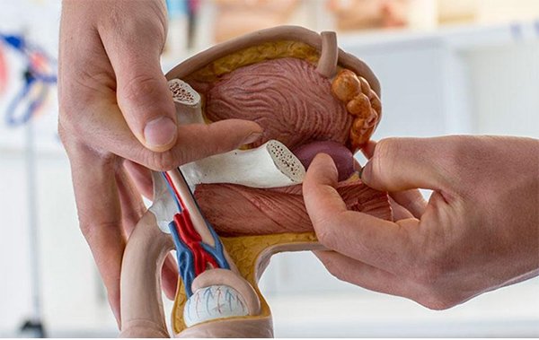 prosterafit peradangan prostat