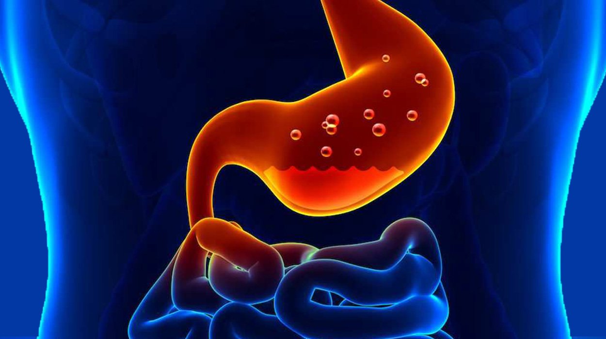 soluma maag bisa sembuh total