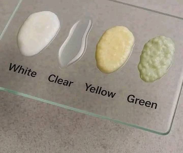 vertomen warna sperma berubah