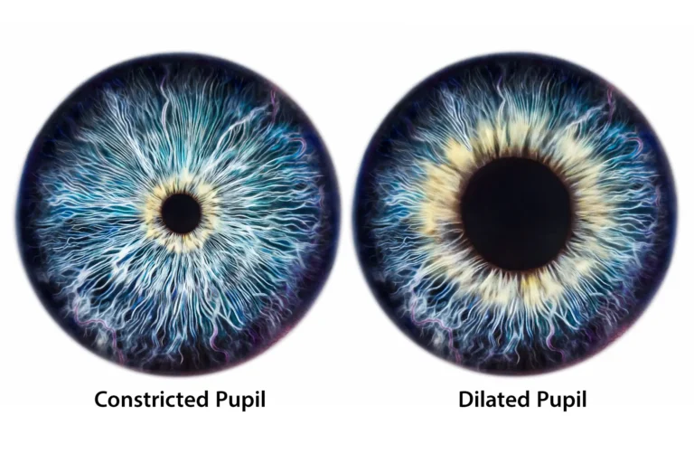 Penyebab Pupil Mata Mengecil atau Melebar