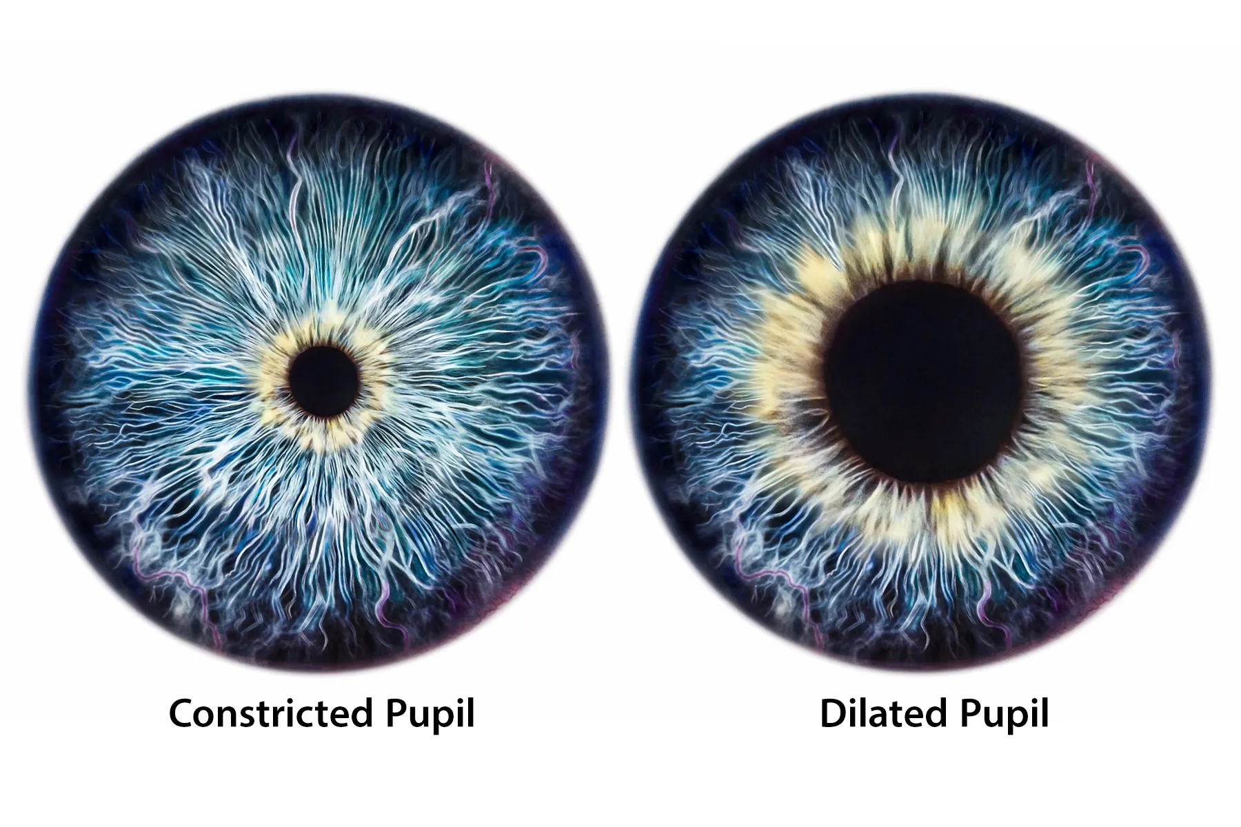 Penyebab Pupil Mata Mengecil atau Melebar