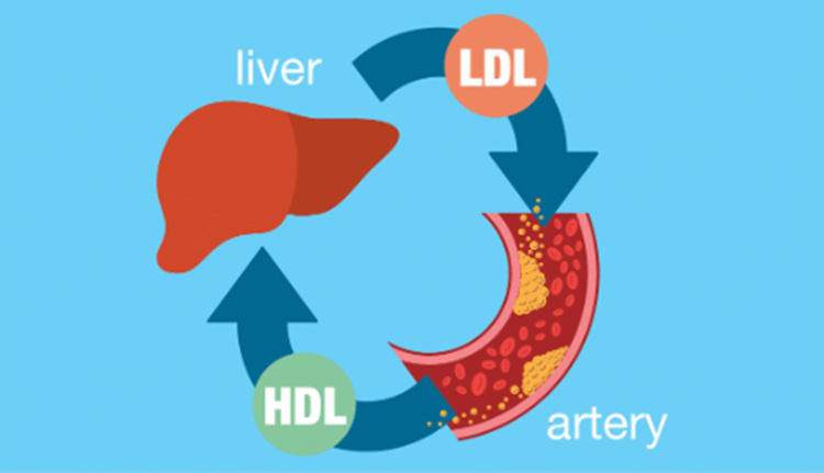 afiapro perbedaan kolesterol