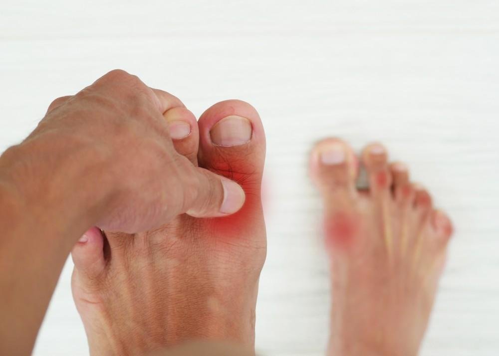 afiapro asam urat naik