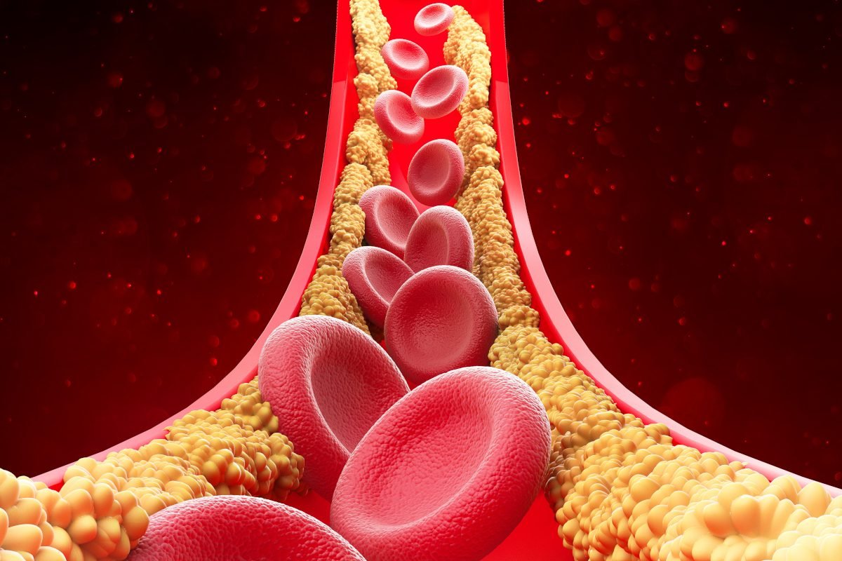 afiapro kolesterol turun