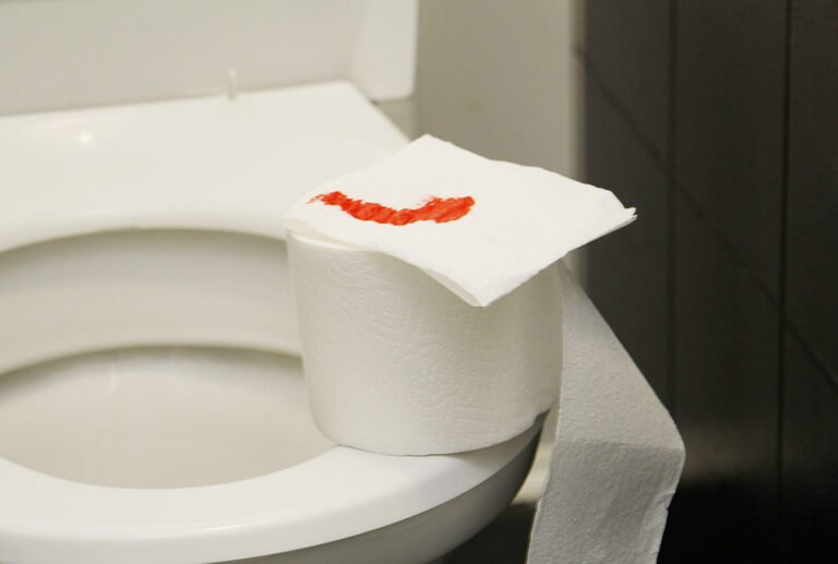 hemotera wasir pecah