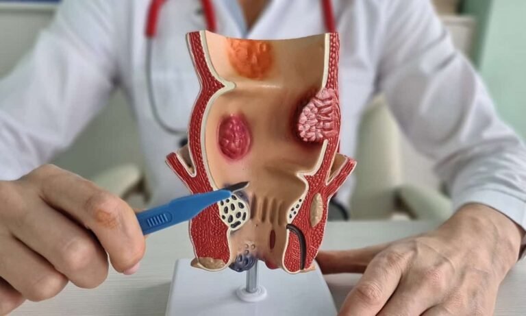 hemotera nyeri anus saat hamil