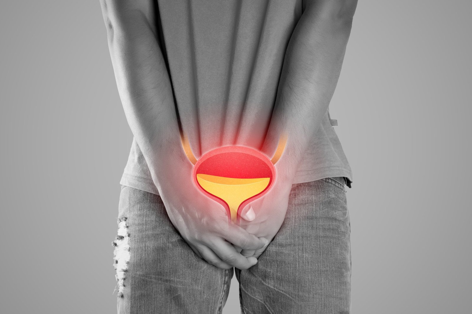 prosterafit dinding kandung kemih