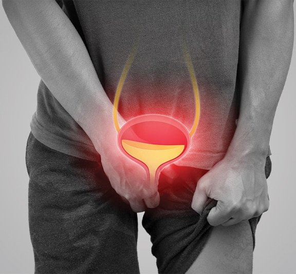 prosterafit penyakit prostat berbahaya