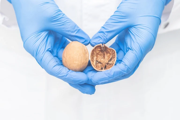 prosterafit diagnosis kanker prostat