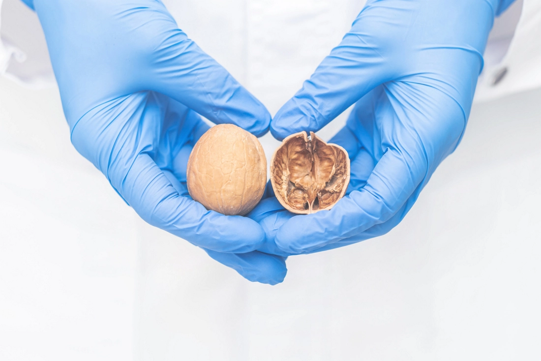 prosterafit diagnosis kanker prostat