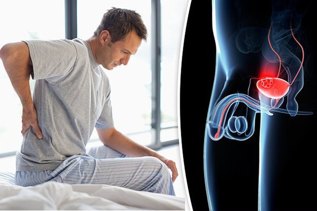 prosterafit prostatitis sering kambuh