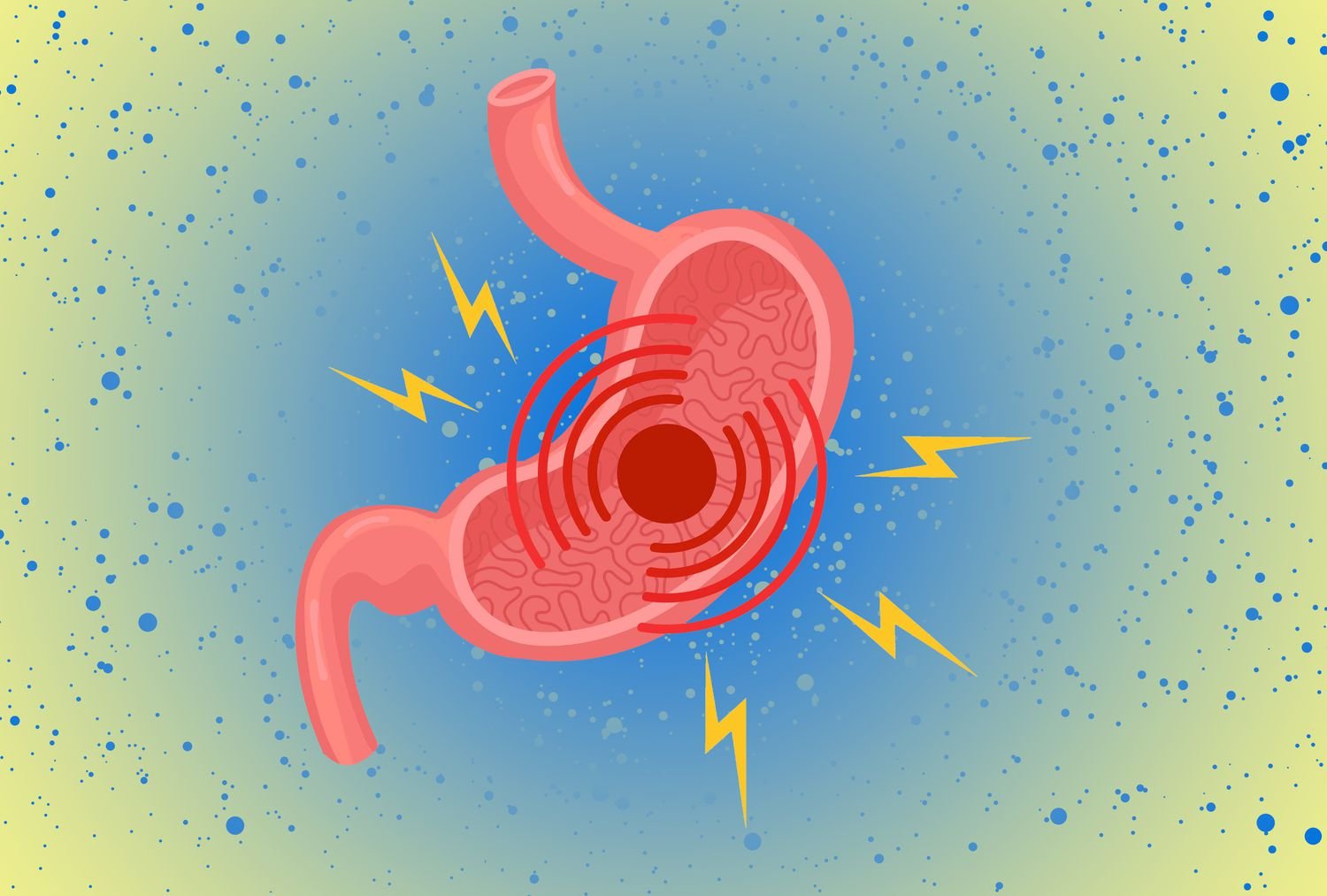 soluma lambung bocor mengancam jiwa