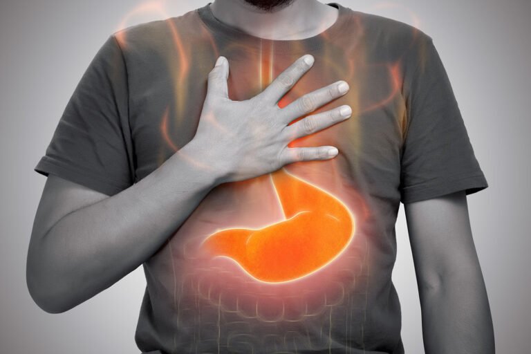 soluma cara mengatasi radang lambung