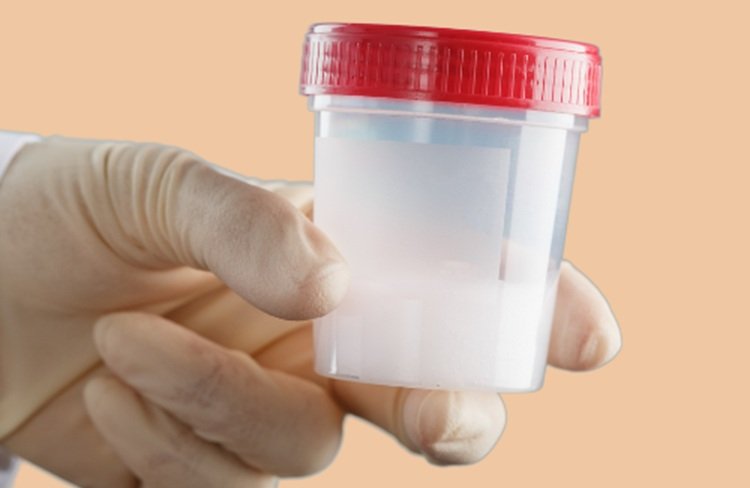 vertomen analisis sperma