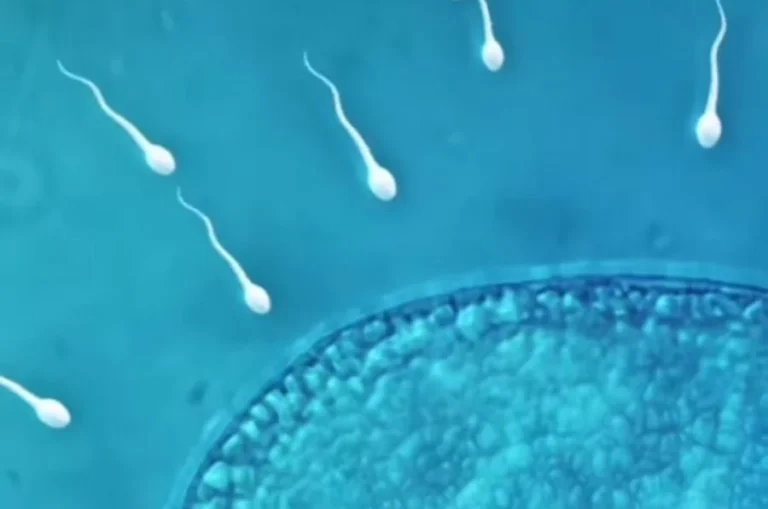 vertomen asthenozoospermia