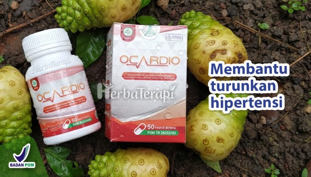 ocardio Bahaya Aneurisma Pembuluh Darah Pecah Akibat Tekanan Darah Terlalu Tinggi