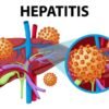 Dampak Infeksi Virus Hepatitis terhadap Gagal Hati