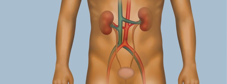Gagal Ginjal Kronis Komplikasi Serius Akibat Darah Tinggi