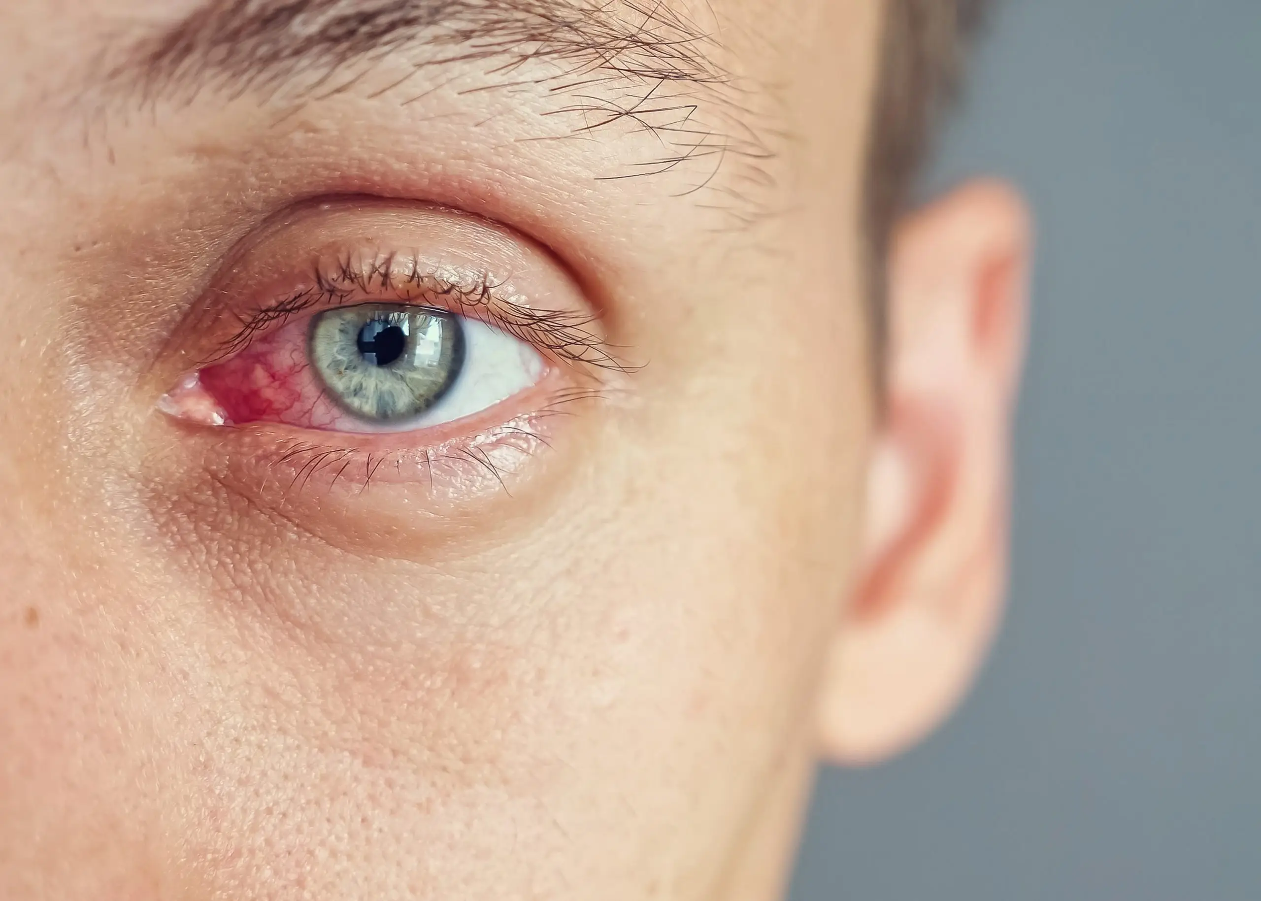 Mata Berair Padahal Kering Ini Alasan Medis di Baliknya