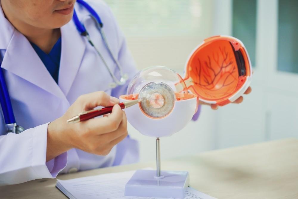 Mata Merah Akibat Alergi Kenali Pemicu dan Cara Mengatasinya