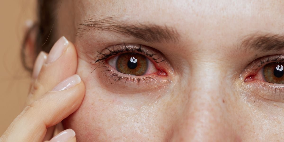 Pandangan Kabur Mendadak Bisa Jadi Tanda Stroke Mata