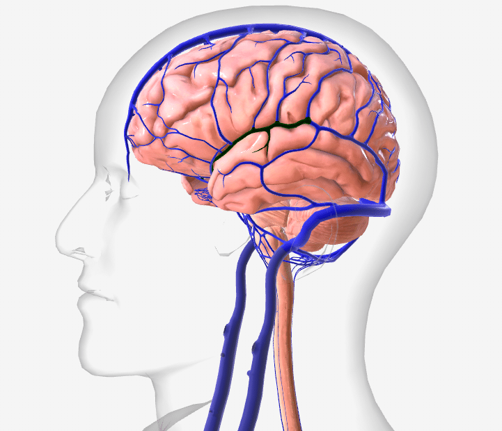 Pembuluh Darah Bocor Akibat Tekanan Darah Tinggi begini penjelasannya