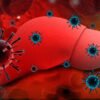 Perbedaan Hepatitis Akut dan Kronis