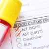 Prosedur Tes Darah dan Fungsi Hati (SGOTSGPT) untuk Diagnosis Hepatitis